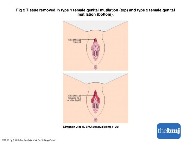 Scar tissue at bottom of vagina Bonnie tyler naked